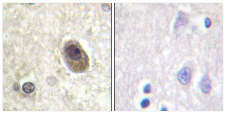 BAD Antibody - Immunohistochemistry analysis of paraffin-embedded human brain, using BAD (Phospho-Ser134) Antibody. The picture on the right is blocked with the phospho peptide.