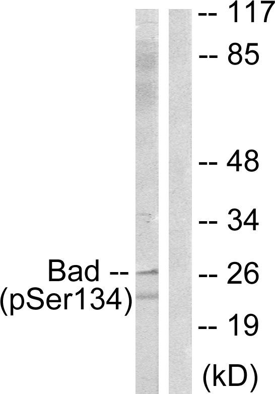 BAD Antibody - Western blot analysis of extracts from mouse liver cells, using BAD (Phospho-Ser134) antibody.
