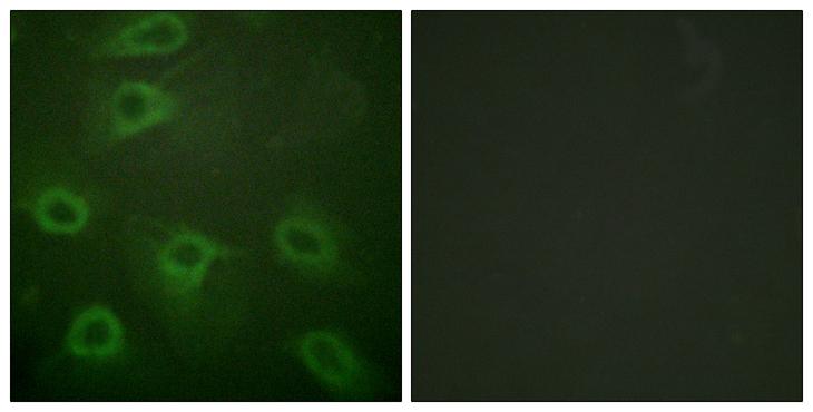BAD Antibody - P-peptide - + Immunofluorescence analysis of HeLa cells, using BAD (Phospho-Ser134) antibody.