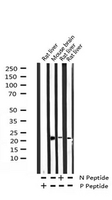 BAD Antibody - Western blot analysis of Phospho-BAD (Ser136) expression in various lysates