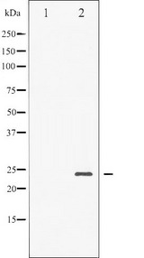BAD Antibody - Western blot analysis of BAD phosphorylation expression in Forskolin treated NIH-3T3 whole cells lysates. The lane on the left is treated with the antigen-specific peptide.