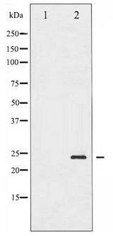 BAD Antibody - Western blot of BAD phosphorylation expression in Forskolin treated 293 whole cell lysates,The lane on the left is treated with the antigen-specific peptide.