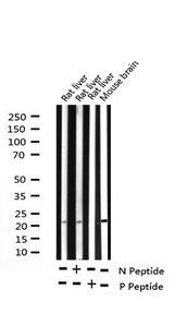 BAD Antibody - Western blot analysis of Phospho-BAD (Ser155) expression in various lysates