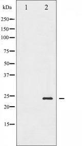 BAD Antibody - Western blot analysis of BAD phosphorylation expression in Forskolin treated 293 whole cells lysates. The lane on the left is treated with the antigen-specific peptide.