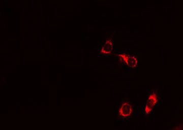 BAD Antibody - Staining 293 cells by IF/ICC. The samples were fixed with PFA and permeabilized in 0.1% Triton X-100, then blocked in 10% serum for 45 min at 25°C. The primary antibody was diluted at 1:200 and incubated with the sample for 1 hour at 37°C. An Alexa Fluor 594 conjugated goat anti-rabbit IgG (H+L) antibody, diluted at 1/600, was used as secondary antibody.