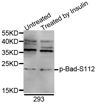 BAD Antibody - Western blot analysis of extracts of 293 cells.