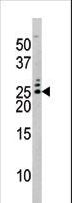 BAD Antibody - The anti-Phospho-Bad-S75 antibody is used in Western blot to detect Phospho-Bad-S75 in HL60 tissue lysate