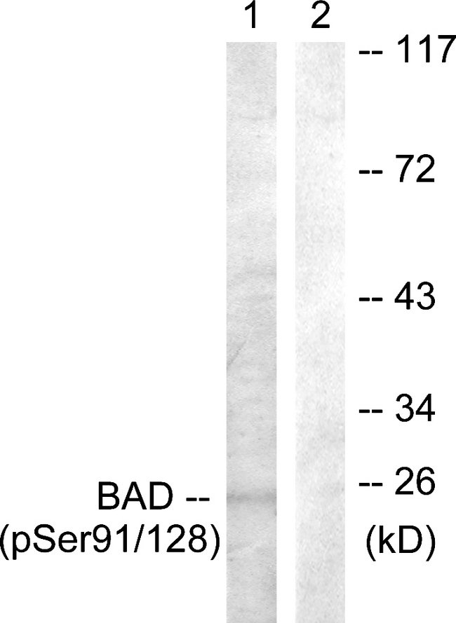 BAD Antibody - Western blot analysis of lysates from COS7 cells treated with TNF-a 20ng/ml+Calyculin A 50nM 5', using BAD (Phospho-Ser91/128) Antibody. The lane on the right is blocked with the phospho peptide.