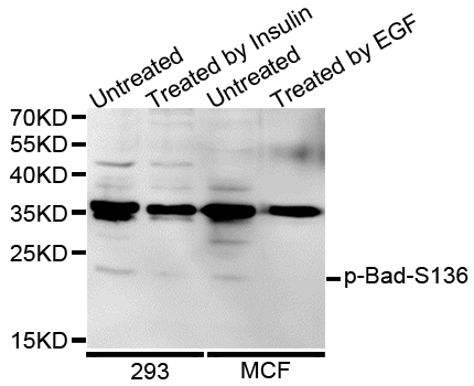 BAD Antibody - Western blot analysis of extracts of various cells.