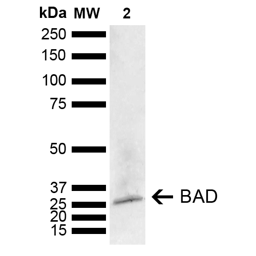 BAD Antibody - Western blot analysis of Mouse Brain showing detection of ~18.3 kDa BAD protein using Rabbit Anti-BAD Polyclonal Antibody. Lane 1: Molecular Weight Ladder (MW). Lane 2: Mouse Brain. Load: 15 µg. Block: 5% Skim Milk in 1X TBST. Primary Antibody: Rabbit Anti-BAD Polyclonal Antibody  at 1:1000 for 2 hours at RT. Secondary Antibody: Goat Anti-Rabbit IgG: HRP at 1:5000 for 1 hour at RT. Color Development: ECL solution for 5 min at RT. Predicted/Observed Size: ~18.3 kDa. Other Band(s): ~25 kDa (PTM).
