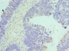 BAF53 / ACTL6A Antibody - Immunohistochemistry of paraffin-embedded human ovary using antibody at 1:100 dilution.