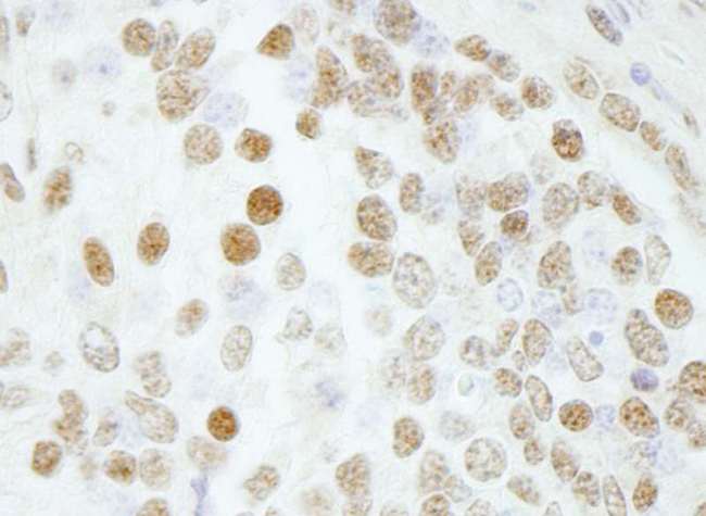 BAF53 / ACTL6A Antibody - Detection of Mouse BAF53A by Immunohistochemistry. Sample: FFPE section of mouse teratoma. Antibody: Affinity purified rabbit anti-BAF53A used at a dilution of 1:250.