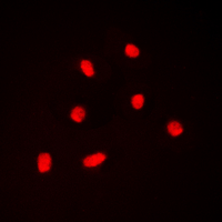 BAF53 / ACTL6A Antibody - Immunofluorescent analysis of BAF53A staining in K562 cells. Formalin-fixed cells were permeabilized with 0.1% Triton X-100 in TBS for 5-10 minutes and blocked with 3% BSA-PBS for 30 minutes at room temperature. Cells were probed with the primary antibody in 3% BSA-PBS and incubated overnight at 4 C in a humidified chamber. Cells were washed with PBST and incubated with a DyLight 594-conjugated secondary antibody (red) in PBS at room temperature in the dark. DAPI was used to stain the cell nuclei (blue).