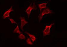 BAF53 / ACTL6A Antibody - Staining HeLa cells by IF/ICC. The samples were fixed with PFA and permeabilized in 0.1% Triton X-100, then blocked in 10% serum for 45 min at 25°C. The primary antibody was diluted at 1:200 and incubated with the sample for 1 hour at 37°C. An Alexa Fluor 594 conjugated goat anti-rabbit IgG (H+L) Ab, diluted at 1/600, was used as the secondary antibody.