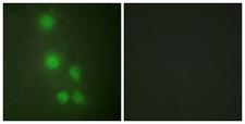 BAF53 / ACTL6A Antibody - Peptide - + Immunofluorescence analysis of HUVEC cells, using ACL6A antibody.
