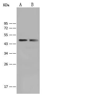 BAF53 / ACTL6A Antibody - Anti-ACTL6A rabbit polyclonal antibody at 1:500 dilution. Lane A: HeLa Whole Cell Lysate. Lane B: Jurkat Whole Cell Lysate. Lysates/proteins at 30 ug per lane. Secondary: Goat Anti-Rabbit IgG (H+L)/HRP at 1/10000 dilution. Developed using the ECL technique. Performed under reducing conditions. Predicted band size: 47kDa.