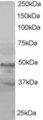 BAF53A / BAF53B Antibody - Antibody staining (1 ug/ml) of HeLa lysate (RIPA buffer, 35 ug total protein per lane). Primary incubated for 1 hour. Detected by Western blot of chemiluminescence.