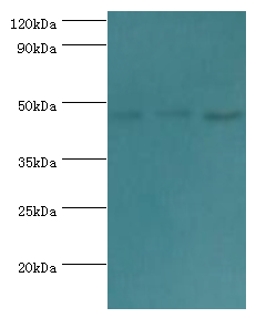 BAF53B / ACTL6B Antibody - Western blot. All lanes: Actin-like protein 6B antibody at 3 ug/ml. Lane 1: HeLa whole cell lysate. Lane 2: U251 whole cell lysate. Lane 3: HepG2 whole cell lysate. Secondary antibody: Goat polyclonal to rabbit at 1:10000 dilution. Predicted band size: 47 kDa. Observed band size: 47 kDa.