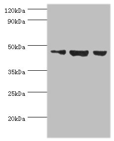 BAF53B / ACTL6B Antibody - Western blot All lanes: Actin-like protein 6B antibody at 3µg/ml Lane 1: Hela whole cell lysate Lane 2: U251 whole cell lysate Lane 3: HepG2 whole cell lysate Secondary Goat polyclonal to rabbit IgG at 1/10000 dilution Predicted band size: 47 kDa Observed band size: 47 kDa