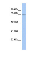 BAF60B / SMARCD2 Antibody - SMARCD2 antibody Western blot of THP-1 cell lysate. This image was taken for the unconjugated form of this product. Other forms have not been tested.