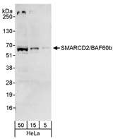 BAF60B / SMARCD2 Antibody - Detection of Human SMARCD2/BAF60b by Western Blot. Samples: Whole cell lysate (5, 15 and 50 ug) from HeLa cells. Antibody: Affinity purified rabbit anti-SMARCD2/BAF60b antibody used for WB at 0.04 ug/ml. Detection: Chemiluminescence with an exposure time of 30 seconds.