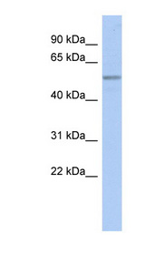 BAF60B / SMARCD2 Antibody - SMARCD2 antibody Western blot of COLO205 cell lysate. This image was taken for the unconjugated form of this product. Other forms have not been tested.