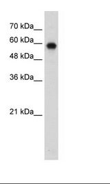 BAF60B / SMARCD2 Antibody - Jurkat Cell Lysate.  This image was taken for the unconjugated form of this product. Other forms have not been tested.