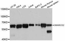 BAF60B / SMARCD2 Antibody - Western blot analysis of extracts of various cell lines, using SMARCD2 antibody at 1:3000 dilution. The secondary antibody used was an HRP Goat Anti-Rabbit IgG (H+L) at 1:10000 dilution. Lysates were loaded 25ug per lane and 3% nonfat dry milk in TBST was used for blocking. An ECL Kit was used for detection and the exposure time was 30s.