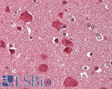 BAF60C / SMARCD3 Antibody - Human Brain, Cortex: Formalin-Fixed, Paraffin-Embedded (FFPE).  This image was taken for the unconjugated form of this product. Other forms have not been tested.