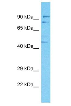 BAF60C / SMARCD3 Antibody - BAF60C / SMARCD3 antibody Western Blot of Jurkat whole cell lysate. Antibody dilution: 1 ug/ml.  This image was taken for the unconjugated form of this product. Other forms have not been tested.