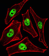 BAF60C / SMARCD3 Antibody - Fluorescent image of HeLa cells stained with SMARCD3 Antibody. Antibody was diluted at 1:25 dilution. An Alexa Fluor 488-conjugated goat anti-rabbit lgG at 1:400 dilution was used as the secondary antibody (green). Cytoplasmic actin was counterstained with Alexa Fluor 555 conjugated with Phalloidin (red).