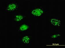 BAF60C / SMARCD3 Antibody - Immunofluorescence of monoclonal antibody to SMARCD3 on HeLa cell. [antibody concentration 10 ug/ml]