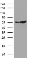 BAF60C / SMARCD3 Antibody - HEK293T cells were transfected with the pCMV6-ENTRY control. (Left lane) or pCMV6-ENTRY SMARCD3. (Right lane) cDNA for 48 hrs and lysed. Equivalent amounts of cell lysates. (5 ug per lane) were separated by SDS-PAGE and immunoblotted with anti-SMARCD3. (1:2000)