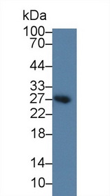 BAFF Receptor / CD268 Antibody - Western Blot; Sample: Rat Spleen lysate; ;Primary Ab: 2µg/ml Rabbit Anti-Mouse BAFFR Antibody;Second Ab: 0.2µg/mL HRP-Linked Caprine Anti-Rabbit IgG Polyclonal Antibody;