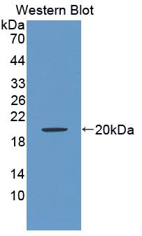 BAFF Receptor / CD268 Antibody - Western Blot; Sample: Recombinant protein.