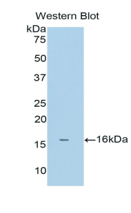 BAFF Receptor / CD268 Antibody - Western blot of recombinant BAFF Receptor / BAFF-R.  This image was taken for the unconjugated form of this product. Other forms have not been tested.