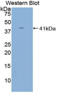 BAFF Receptor / CD268 Antibody - Western blot of BAFF Receptor antibody.
