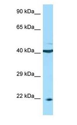 BAFF Receptor / CD268 Antibody - BAFF Receptor / BAFF-R antibody Western Blot of 721_B.  This image was taken for the unconjugated form of this product. Other forms have not been tested.