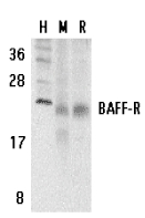 BAFF Receptor / CD268 Antibody - Western blot of BAFF-R in human (H), mouse (M), and rat (R) spleen tissue lysates with BAFF-R antibody at 5 ug/ml.