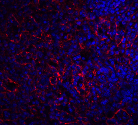 BAFF Receptor / CD268 Antibody - Immunofluorescence of BAFF-R in human spleen tissue with BAFF-R antibody at 20 ug/ml.  Red: BAFF Receptor Antibody  Blue: DAPI staining