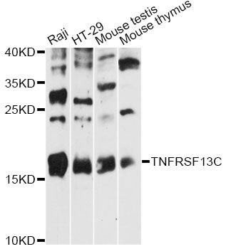 BAFF Receptor / CD268 Antibody - Western blot analysis of extracts of various cell lines, using TNFRSF13C antibody at 1:3000 dilution. The secondary antibody used was an HRP Goat Anti-Rabbit IgG (H+L) at 1:10000 dilution. Lysates were loaded 25ug per lane and 3% nonfat dry milk in TBST was used for blocking. An ECL Kit was used for detection and the exposure time was 20s.