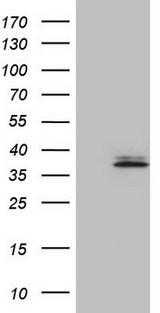 BAFF / TNFSF13B Antibody - HEK293T cells were transfected with the pCMV6-ENTRY control. (Left lane) or pCMV6-ENTRY TNFSF13B. (Right lane) cDNA for 48 hrs and lysed. Equivalent amounts of cell lysates. (5 ug per lane) were separated by SDS-PAGE and immunoblotted with anti-TNFSF13B. (1:500)