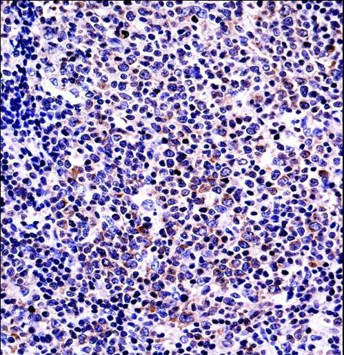 BAFF / TNFSF13B Antibody - TNFSF13B Antibody immunohistochemistry of formalin-fixed and paraffin-embedded human tonsil tissue followed by peroxidase-conjugated secondary antibody and DAB staining.
