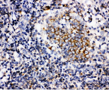 BAFF / TNFSF13B Antibody - BAFF antibody. IHC(P): Human Tonsil Tissue.