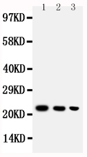 BAFF / TNFSF13B Antibody - Anti-BAFF antibody, Western blotting Lane 1: Recombinant Human BAFF Protein 10ng Lane 2: Recombinant Human BAFF Protein 5ng Lane 3: Recombinant Human BAFF Protein 2. 5ng