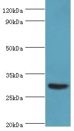 BAFF / TNFSF13B Antibody - Western blot. All lanes: Tumor necrosis factor ligand superfamily member 13B antibody at 2 ug/ml+mouse liver tissue. Secondary antibody: Goat polyclonal to rabbit at 1:10000 dilution. Predicted band size: 31 kDa. Observed band size: 31 kDa Immunohistochemistry.