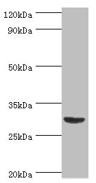 BAFF / TNFSF13B Antibody - Western blot All lanes: Tumor necrosis factor ligand superfamily member 13B antibody at 2µg/ml + Mouse liver tissue Secondary Goat polyclonal to rabbit IgG at 1/10000 dilution Predicted band size: 32, 30, 18 kDa Observed band size: 32 kDa