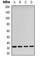 BAFF / TNFSF13B Antibody - Western blot analysis of CD257 expression in HeLa (A); HepG2 (B); mouse spleen (C); mouse liver (D) whole cell lysates.