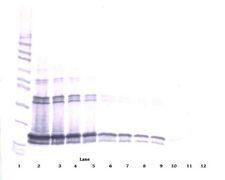 BAFF / TNFSF13B Antibody - Western Blot (non-reducing) of BAFF antibody. This image was taken for the unconjugated form of this product. Other forms have not been tested.