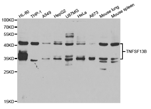 BAFF / TNFSF13B Antibody - Western blot analysis of extracts of various cell lines.